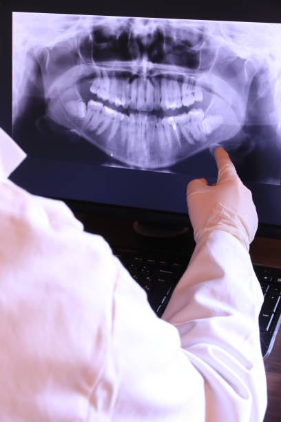 Best Emergency Wisdom Teeth Removal in Stuttgt, AR