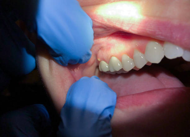 Best Emergency Denture Repair in Stuttgt, AR