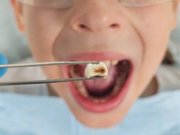 Best Cosmetic Emergency Dentistry in Stuttgt, AR