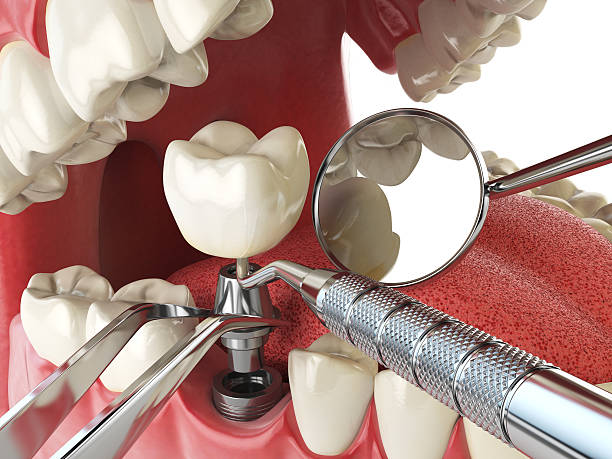 Best Emergency Tooth Extraction in Stuttgt, AR